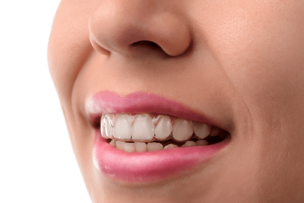 Invisalign in Cornwall, NY