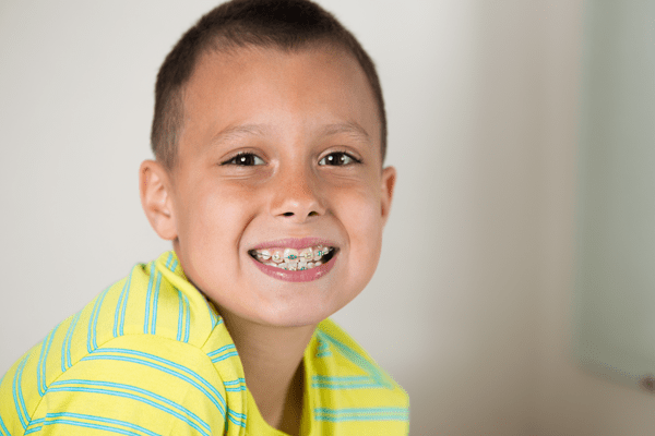 braces in Monticello NY