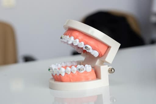 What can braces fix
