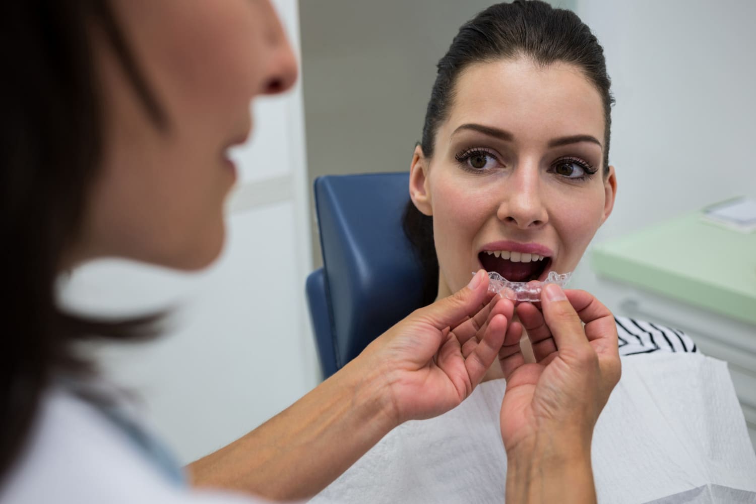 Invisalign vs. Spark Clear Aligners