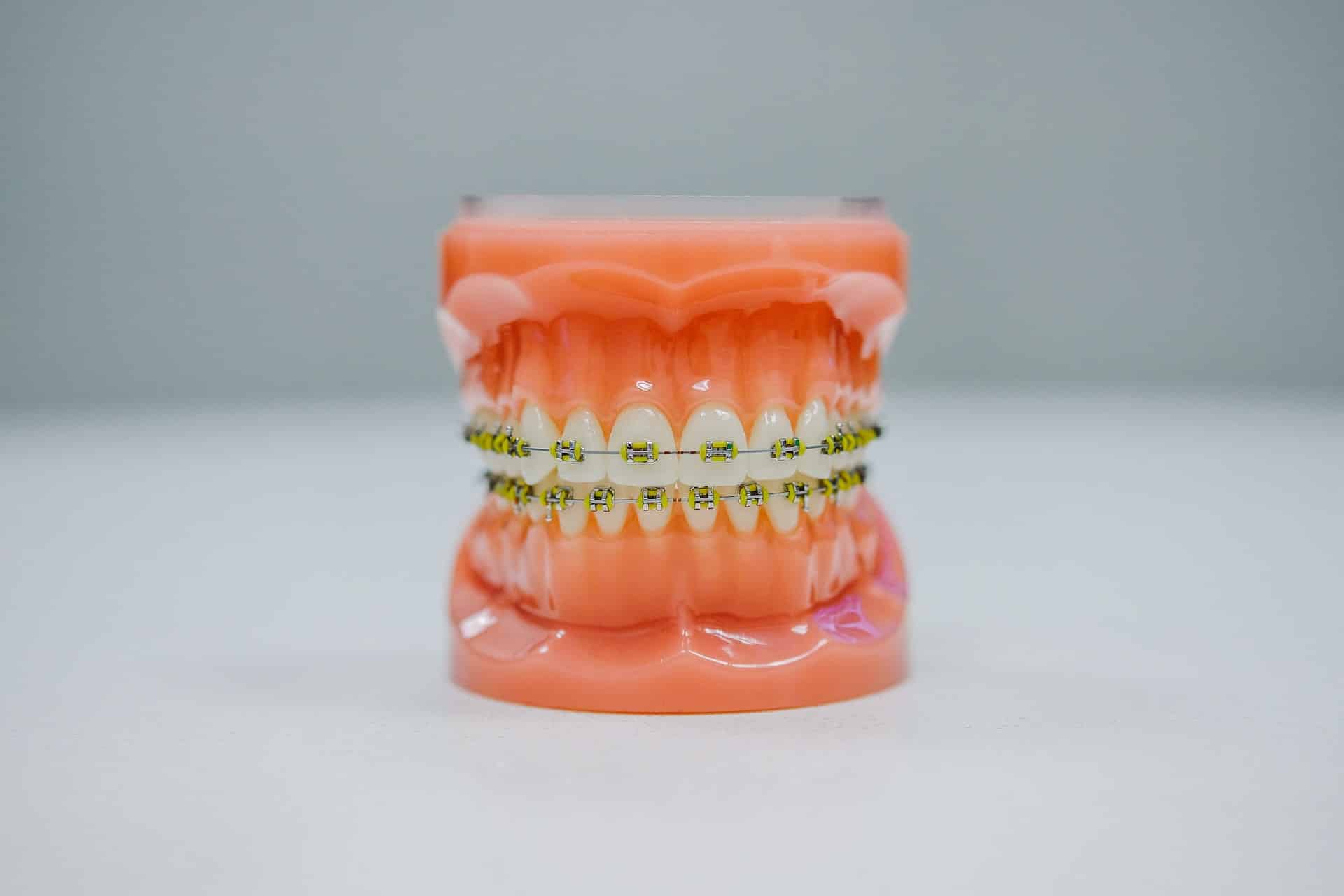 cost to get braces in New York