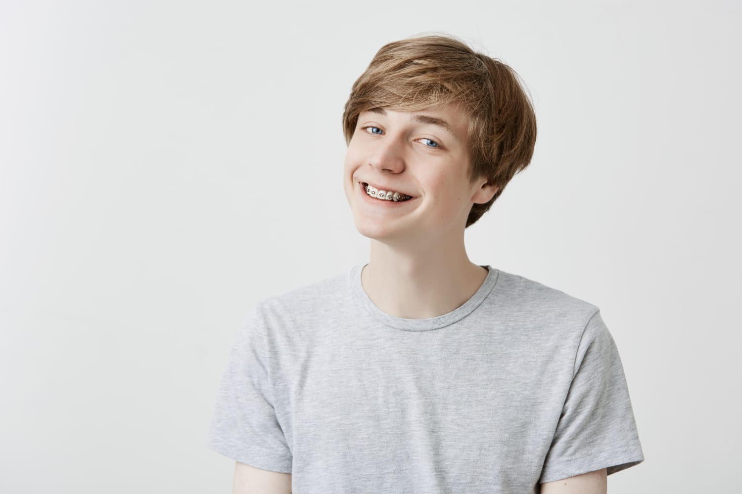Fashion Braces Alert: The Real Cost of This Viral Look